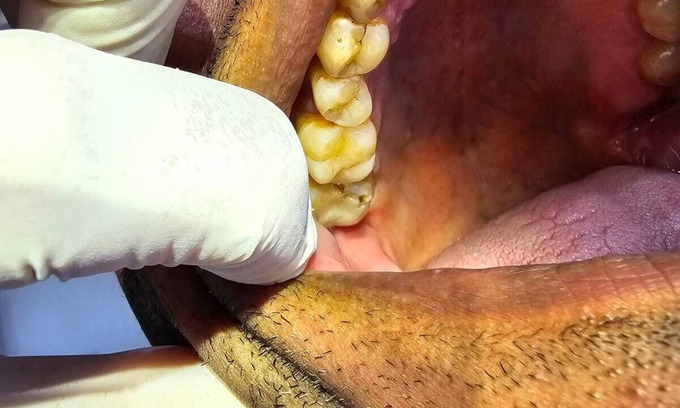 Mata de Sao Joao Apartment | Imbassai , Residencial Ykutiba Resort, beachfront paradise